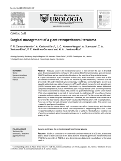 Surgical management of a giant retroperitoneal teratoma - revista