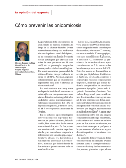 Cómo prevenir las onicomicosis - Más dermatología