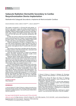 Subacute Radiation Dermatitis Secondary to Cardiac