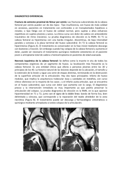 Coxalgia bilateral en paciente gestante (Parte I I)