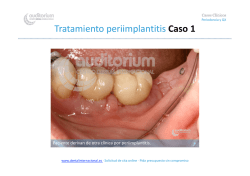 Tratamiento periimplantitis Caso 1
