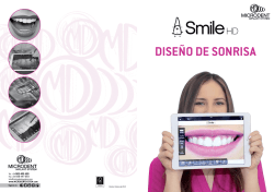 smile hd diseño de sonrisa