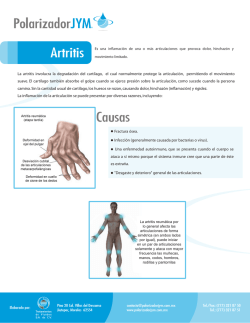 Artritis Causas