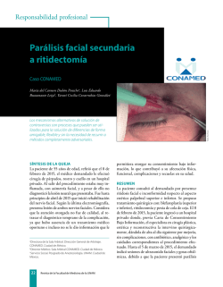 parálisis facial secundaria a ritidectomía
