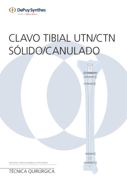 CLAVO TIBIAL UTN/CTN SÓLIDO/CANULADO
