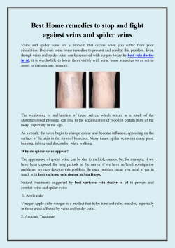 Best Home remedies to stop and fight against veins and spider veins