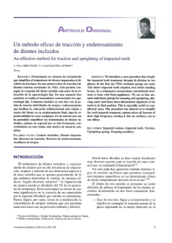 Un método eficaz de tracción y enderezamiento de dientes incluidos.
