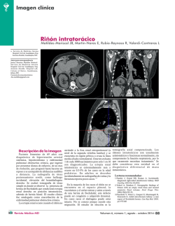 Imagen clinica -Riñon intratorácico.cdr - Revista Médica MD
