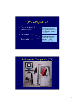 &iquest;C&oacute;mo Digitalizar? Radiograf&iacute;a Computada (CR)
