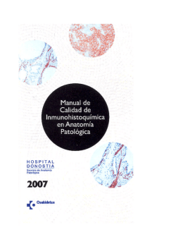 Inmunohistoquímica cast