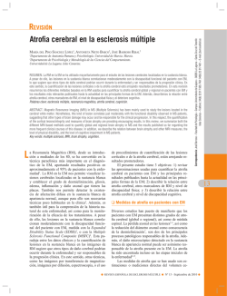 Atrofia cerebral en la esclerosis múltiple