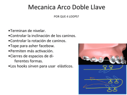 Mecanica Arco Doble Llave