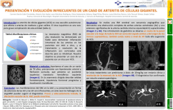 García-Cabo Fernández, Carmen NEUROIMAGEN P2