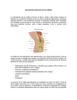 Anatomía de la rodilla y Gonartrosis (desgaste de rodilla)