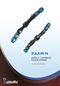 ST.AR90 F4 - Material de Osteosintesis
