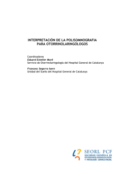 INTERPRETACI&Oacute;N DE LA POLISOMNOGRAFIA PARA