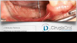 Curso cirugia reconstructiva 2016.key