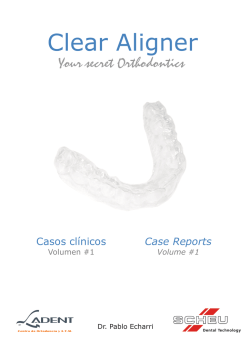 CASE 1 - Clear Aligner