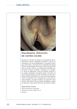 Pseudoasma: disfunción de cuerdas vocales