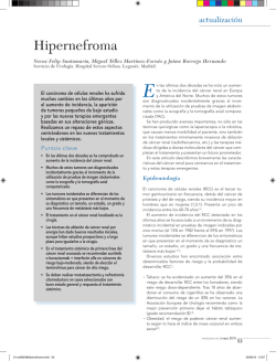 Hipernefroma - Medicina Interna al día