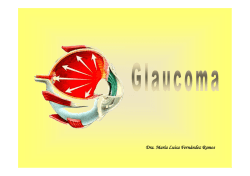Glaucoma de ángulo abierto