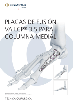 placas de fusión va lcp® 3.5 para columna medial