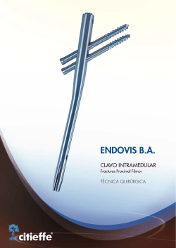 ENDOVIS B.A. - Material de Osteosintesis