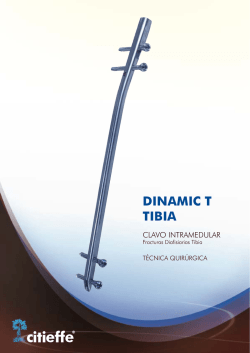 DINAMIC T TIBIA Brochure