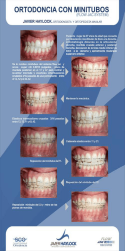 Descargar PDF - Flow Jac System