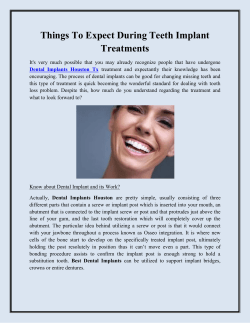 Things To Expect During Teeth Implant Treatments