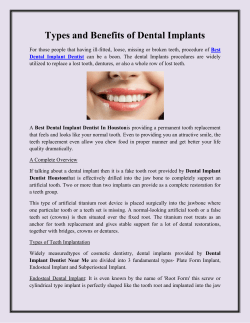 Types and Benefits of Dental Implants