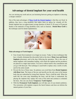 Advantage of dental implant for your oral health
