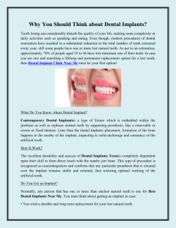 Why You Should Think about Dental Implants