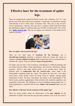 Effective laser for the treatment of spider legs.